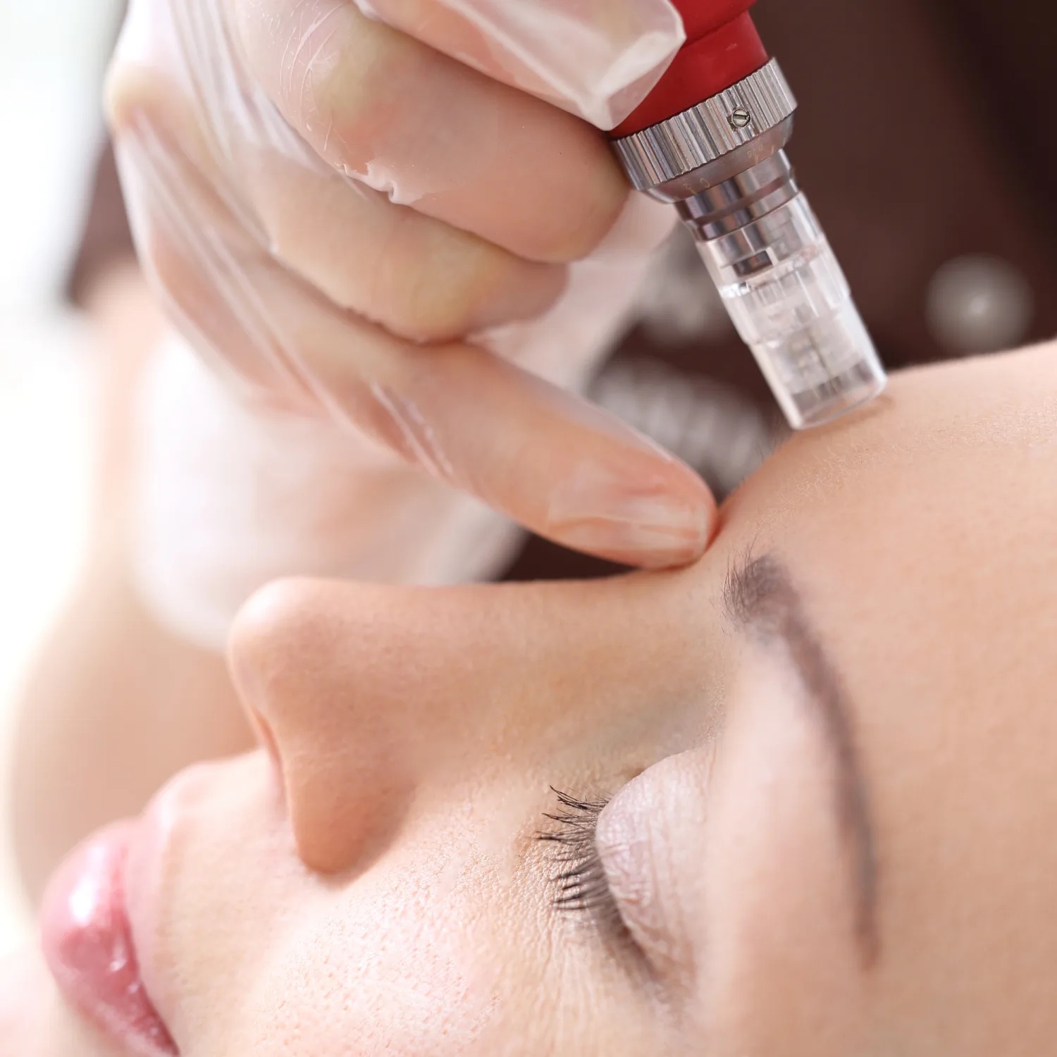 Skin Boosters